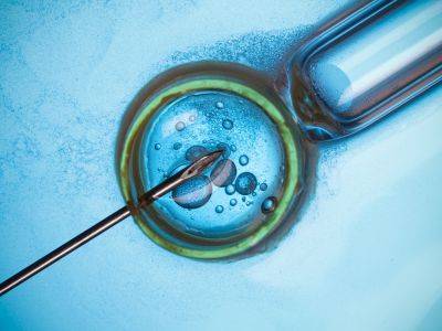 IVF-Delhi-ivf-1