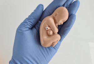 fetus is embryo child doctor gloved hand closeup